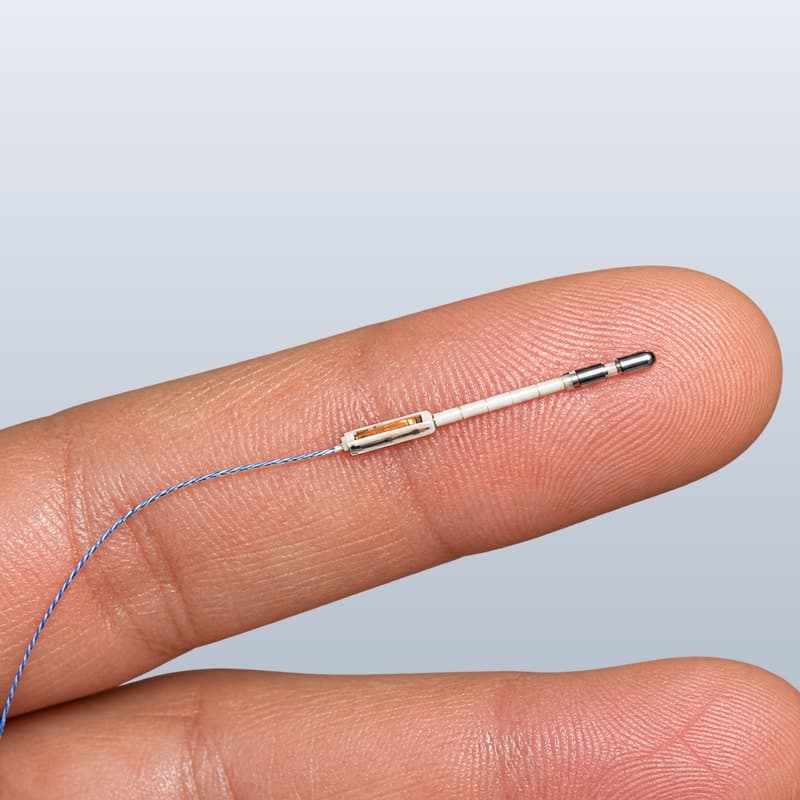 A neuromodulation lead resting on a fingertip for scale